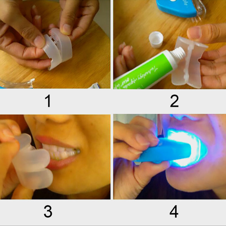 Professional Teeth Whitening Kit with LED Light - At-Home Dental Bleaching System